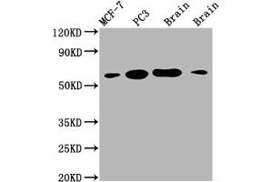 Western Blot Positive WB detected in: MCF-7 whole cell lysate, PC3 whole cell lysate, Mouse brain tissue, Rat brain tissue All lanes: LOXL2 antibody at 1:2000 Secondary Goat polyclonal to rabbit IgG at 1/50000 dilution Predicted band size: 87 kDa Observed band size: 53 kDa (Rekombinanter LOXL2 Antikörper)