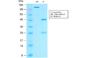 SDS-PAGE Analysis of Purified Estrogen Receptor, alpha Mouse Monoclonal Antibody (rESR1/1935). (Rekombinanter Estrogen Receptor alpha Antikörper)