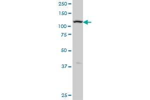 Western Blotting (WB) image for anti-ADAM Metallopeptidase with thrombospondin Type 1 Motif, 17 (ADAMTS17) (AA 543-650) antibody (ABIN566923)