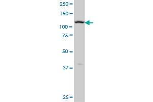 ADAMTS17 monoclonal antibody (M01), clone 3B7 Western Blot analysis of ADAMTS17 expression in A-431 . (ADAMTS17 Antikörper  (AA 543-650))