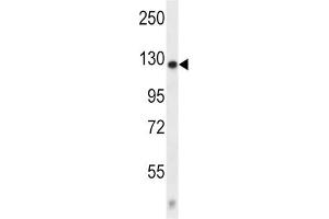 Western Blotting (WB) image for anti-Calcium Channel, Voltage-Dependent, alpha 2/delta Subunit 2 (CACNA2D2) antibody (ABIN2997311) (CACNA2D2 Antikörper)