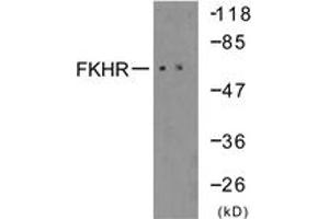 Western blot analysis of extracts from 293 cells, treated with serum 10% 15', using FKHR (Ab-319) Antibody. (FOXO1 Antikörper  (AA 286-335))