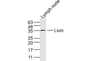 Mouse Lymph node lysates probed with Livin Polyclonal Antibody, Unconjugated  at 1:300 dilution and 4˚C overnight incubation.
