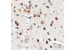 Immunohistochemistry of CHD7 in mouse brain tissue with CHD7 antibody at 5 ug/mL. (CHD7 Antikörper  (N-Term))