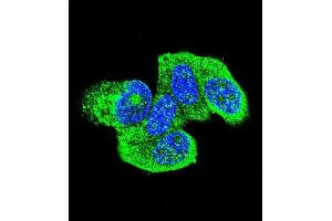 Confocal immunofluorescent analysis of HRAS Antibody (C-term) (ABIN655622 and ABIN2845102) with MCF-7 cell followed by Alexa Fluor 488-conjugated goat anti-rabbit lgG (green). (HRAS Antikörper  (C-Term))