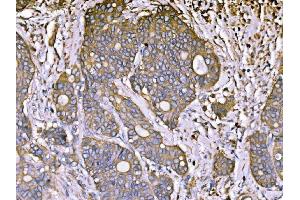 IHC analysis of ATP1B1 using anti-ATP1B1 antibody (ABIN7602014).