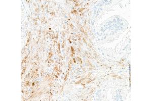Immunohistochemistry (IHC) image for anti-Ubiquitin Carboxyl-terminal Esterase L1 (Ubiquitin Thiolesterase) (UCHL1) (AA 50-100) antibody (ABIN7449527) (Rekombinanter UCHL1 Antikörper  (AA 50-100))