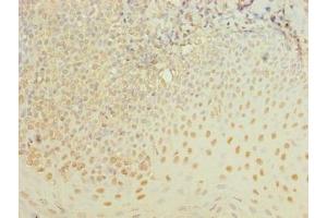 Immunohistochemistry of paraffin-embedded human tonsil tissue using ABIN7175990 at dilution of 1:100