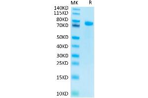 Notch1 Protein (AA 19-526) (His-Avi Tag)