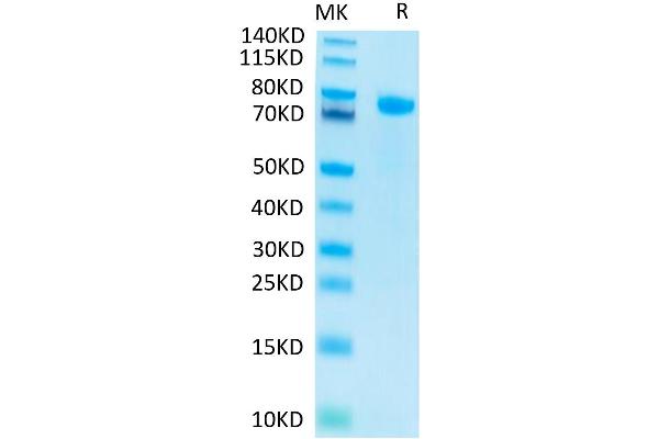 Notch1 Protein (AA 19-526) (His-Avi Tag)