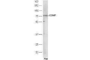 Raji cell lysates probed with Rabbit Anti-COMP Polyclonal Antibody, Unconjugated (ABIN2559644) at 1:300 in 4˚C. (COMP Antikörper  (AA 221-320))