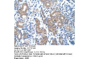 Rabbit Anti-PTGS1 Antibody  Paraffin Embedded Tissue: Human Kidney Cellular Data: Epithelial cells of renal tubule Antibody Concentration: 4. (PTGS1 Antikörper  (N-Term))