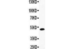 Anti-LIF Picoband antibody,  All lanes: Anti-LIF at 0.