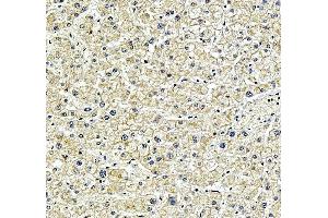 IHC analysis of SPRED2 using anti-SPRED2 antibody (ABIN7601643).