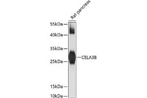 Western blot analysis of extracts of rat pancreas, using CELB antibody (ABIN6133505, ABIN6138397, ABIN6138398 and ABIN6217810) at 1:3000 dilution. (Elastase 3B Antikörper  (AA 80-190))
