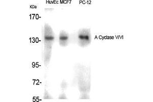 Western Blot (WB) analysis of specific cells using A Cyclase V/VI Polyclonal Antibody. (ADCY5/6 Antikörper  (C-Term))