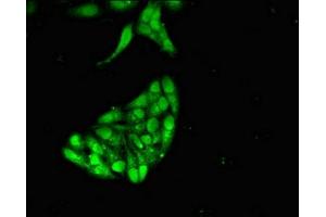 Immunofluorescent analysis of Hela cells using ABIN7158704 at dilution of 1:100 and Alexa Fluor 488-congugated AffiniPure Goat Anti-Rabbit IgG(H+L) (JMJD2D Antikörper  (AA 337-499))