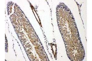 Prolactin Receptor Antikörper  (C-Term)