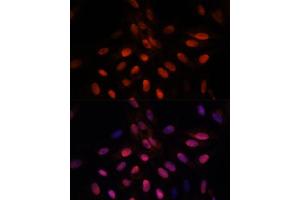 Immunofluorescence analysis of U-2 OS cells using TPI1 antibody (ABIN7270977) at dilution of 1:100. (TPI1 Antikörper  (AA 1-249))