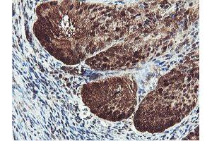 Image no. 5 for anti-Proteasome (Prosome, Macropain) Subunit, beta Type, 7 (PSMB7) (AA 58-277) antibody (ABIN1491598)