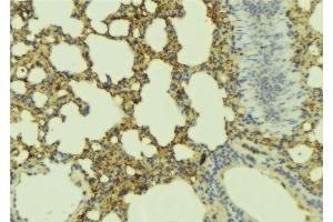 ABIN6277452 at 1/100 staining Mouse lung tissue by IHC-P. (ADCYAP1R1 Antikörper  (C-Term))