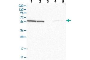 Western blot analysis of Lane 1: RT-4, Lane 2: U-251 MG, Lane 3: Human Plasma, Lane 4: Liver, Lane 5: Tonsil with GOPC polyclonal antibody  at 1:250-1:500 dilution. (GOPC Antikörper)