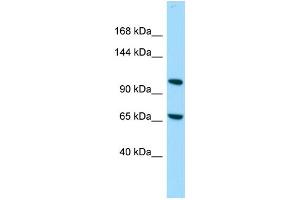 Host: Rabbit Target Name: C14orf43 Sample Type: 721_B Whole Cell lysates Antibody Dilution: 1. (ELMSAN1 Antikörper  (C-Term))