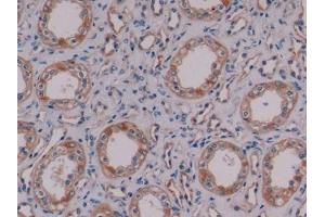 Detection of NES in Human Kidney Tissue using Monoclonal Antibody to Nestin (NES) (Nestin Antikörper  (AA 178-399))