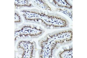 Immunohistochemistry (IHC) image for anti-FBJ Murine Osteosarcoma Viral Oncogene Homolog B (FOSB) (AA 1-100) antibody (ABIN7267159)