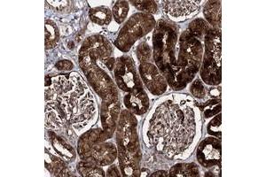 Immunohistochemical staining of human kidney with C10orf67 polyclonal antibody  shows strong cytoplasmic and membranous positivity in cells of tubules. (C10orf67 Antikörper)