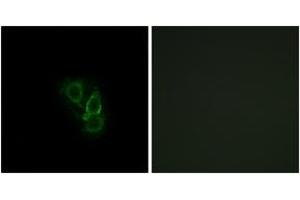 Immunofluorescence analysis of A549 cells, using RAD Antibody.