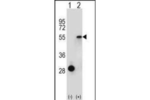 Western blot analysis of ESRRA (arrow) using rabbit polyclonal ESRRA Antibody (Center) (ABIN652575 and ABIN2842387). (ESRRA Antikörper  (AA 131-159))