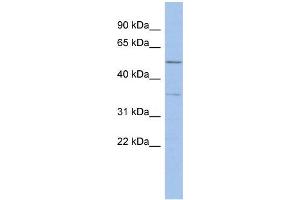 Human ACHN; WB Suggested Anti-ABHD15 Antibody Titration: 0. (ABHD15 Antikörper  (Middle Region))