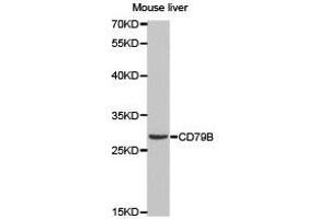 Western Blotting (WB) image for anti-CD79b Molecule, Immunoglobulin-Associated beta (CD79B) antibody (ABIN1871654) (CD79b Antikörper)