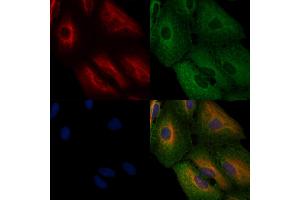 ABIN6262303 and ABIN6276781 staining  cells by IF/ICC. (HMGCR Antikörper  (N-Term))
