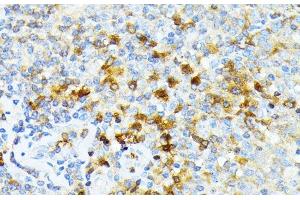 Immunohistochemistry of paraffin-embedded Human tonsil using SPTA1 Polyclonal Antibody at dilution of 1:100 (40x lens). (SPTA1 Antikörper)