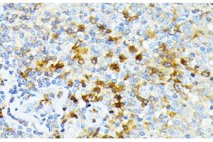 Immunohistochemistry of paraffin-embedded Human tonsil using SPTA1 Polyclonal Antibody at dilution of 1:100 (40x lens).