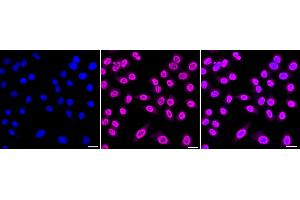 Immunocytochemical staining of HepG2 cells with Phospho-Nucleophosmin (T199) antibody (ABIN7799673), 1:1,000). (Rekombinanter NPM1 Antikörper  (pThr199))