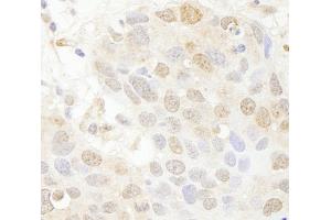 Immunohistochemistry (IHC) image for anti-SET Domain Containing 8 Pseudogene 1 (SETD8P1) (AA 316-366) antibody (ABIN7448789)
