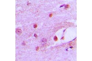 Immunohistochemical analysis of MSH6 staining in human brain formalin fixed paraffin embedded tissue section. (MSH6 Antikörper  (Center))