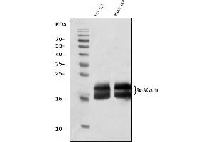 Western blot analysis of Alpha A Crystallin using anti-Alpha A Crystallin antibody (ABIN7599030).