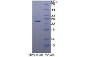 SDS-PAGE (SDS) image for TIMP Metallopeptidase Inhibitor 4 (TIMP4) (AA 32-224) protein (His tag) (ABIN2122234)