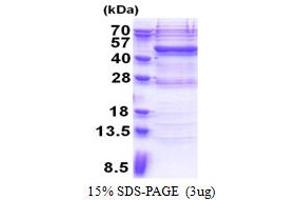 SDS-PAGE (SDS) image for Vav 1 Oncogene (VAV1) (AA 189-565) protein (His tag) (ABIN6387328) (VAV1 Protein (AA 189-565) (His tag))
