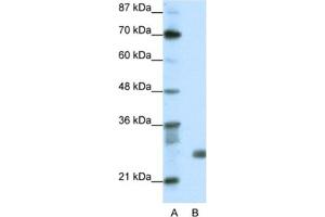 Western Blotting (WB) image for anti-Sin3A-Associated Protein, 30kDa (SAP30) antibody (ABIN2461707)