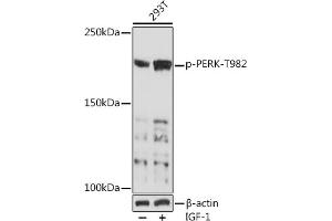 Western blot analysis of extracts of 293T cells, using Phospho-PERK-T982 Rabbit pAb (ABIN7267032) at 1:1000 dilution. (PERK Antikörper  (pThr982))