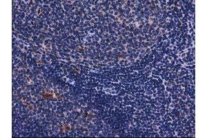 Image no. 1 for anti-Sequestosome 1 (SQSTM1) antibody (ABIN1499987) (SQSTM1 Antikörper)