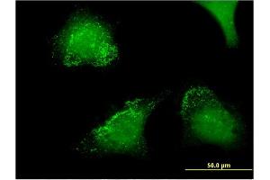 Immunofluorescence of monoclonal antibody to ACP5 on HeLa cell.