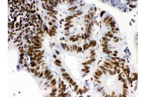 Immunohistochemistry (Paraffin-embedded Sections) (IHC (p)) image for anti-Retinoblastoma Binding Protein 4 (RBBP4) (AA 395-425), (C-Term) antibody (ABIN3043920) (Retinoblastoma Binding Protein 4 Antikörper  (C-Term))