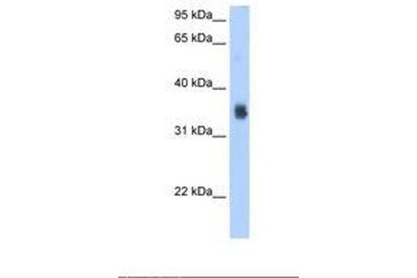 SLC35F2 antibody  (N-Term)
