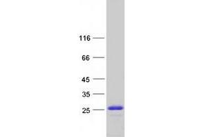 Western Blotting (WB) image for High Mobility Group Nucleosome Binding Domain 1 (HMGN1) protein (Myc-DYKDDDDK Tag) (ABIN2722877)